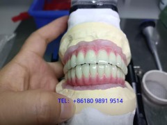 欧美诊所指定种植牙代工厂（快速交付与高精度生产）深圳义齿厂家