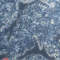 CCK-81（人结肠癌腺癌细胞）微生物菌种查询网细胞系