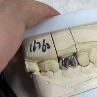 面向海外诊所、经销商与连锁店｜中国认证义齿工厂开放长期产能｜支持OEM/ODM定制